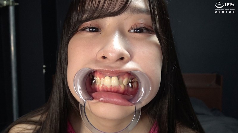 クローズアップ 【歯＆口腔】人気女優 朝比ゆのチャンの歯＆口腔＆のどちんこ観察と小魚舐め！