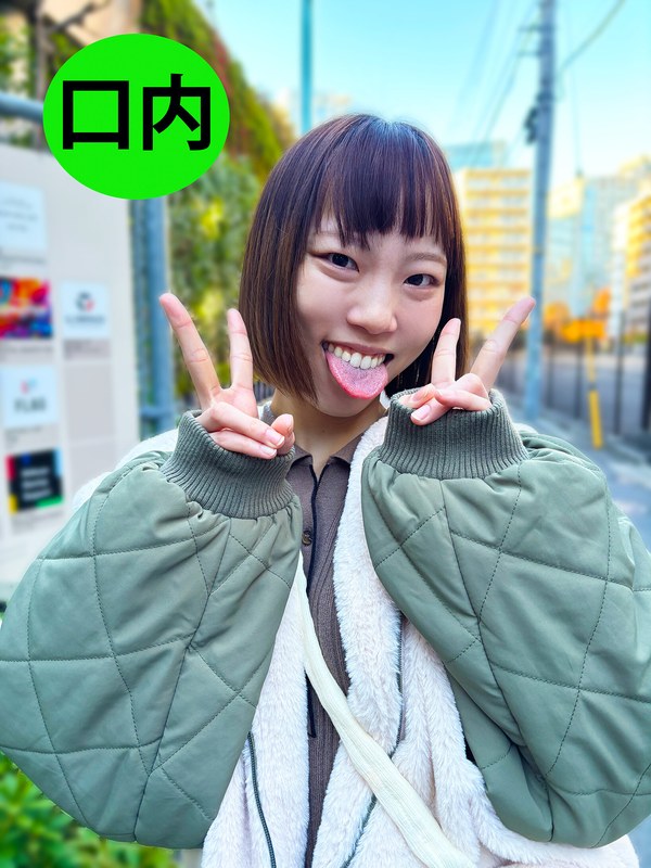 アンケート 街角で声をかけて口内観察させてもらう オーガニックスーパー勤務 はつみちゃん