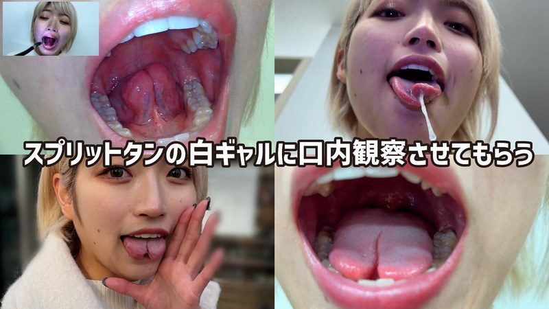 美容部員 街角で声をかけて口内観察させてもらう 美容部員 はるのちゃん