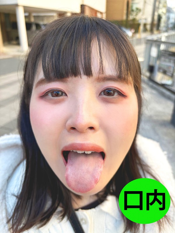 コールセンター 街角で声をかけて口内観察させてもらう コールセンターアルバイト あむちゃん