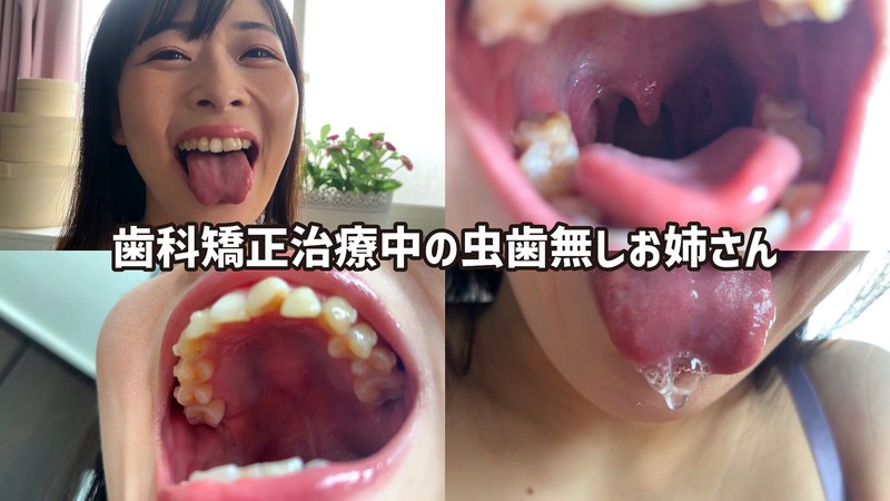 口内観察 街角で声をかけて口内観察させてもらう ファーストフード店パート みおりさん