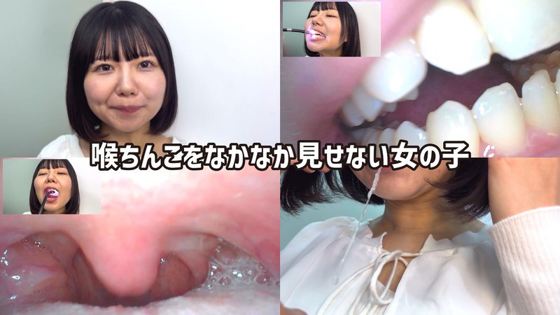 攻略法 街角で声をかけて口内観察させてもらう テレビ局AD みゆりちゃん