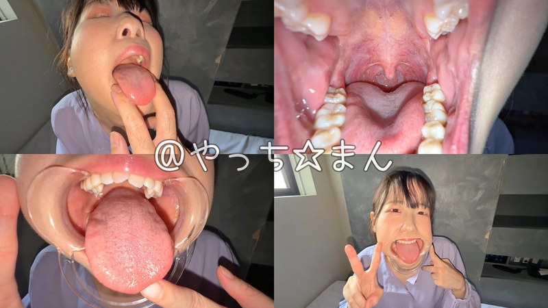口内観察 【個人撮影】谷田かりな 開口器で口内観察デカ舌を要チェック