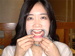 アドア 初めての口内・のどちんこ観察！ことね（5）