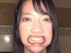 物語 超・超・超貴重な口内・銀歯・のどちんこ観察！葉月英里