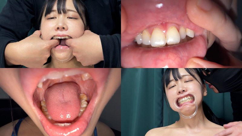 ペロネ よだれダラダラすずちゃんの口内観察