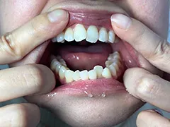 唾液たっぷりかりなちゃんの口内観察