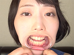 アドア 「大人気美女ゆきねさんの激レア口内・銀歯観察！」